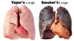 Vapors Lungs, Smokers Lungs